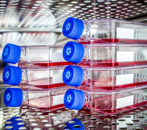 Tissue culture Tissue culture