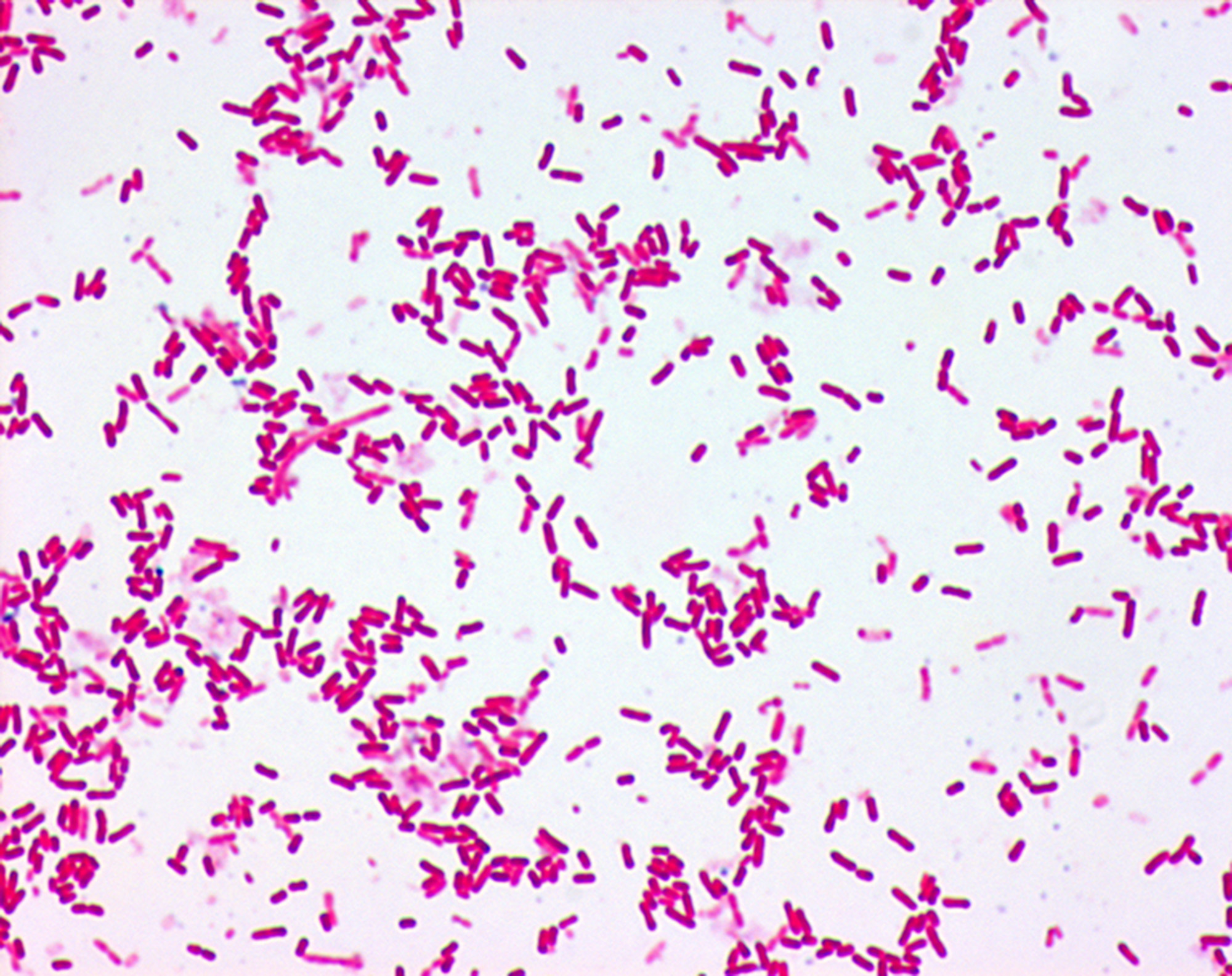Бактерия spp. Pantoea agglomerans. Энтеробактер аэрогенес. Бактерии рода Pantoea. Энтеробактерии агломеранс.